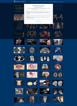 Snimka zaslona radiologyassistant.nl